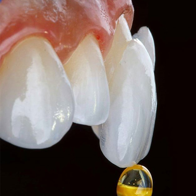 ونیر و لمینت و veneer